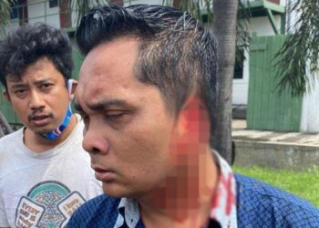 SEORANG penunggang motosikal menggigit telinga konduktor bas kerana enggan beri laluan untuk memintas kenderaan tersebut. - TRIBUNNEWS