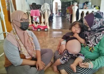 NURAIRIS Maisarah Mohd. Zulkarnaen yang mengalami penyakit bengkak anggota badan dan saiz perut semakin membesar dipangku ibu saudaranya bersama Nor Faizah Mohamad Hamizam (kiri) di Perumahan Rancangan Tanah Pemuda (PRTP) Kampung Bukit Dinding, Jerantut, Pahang.  - UTUSAN/HARIS FADILAH AHMAD