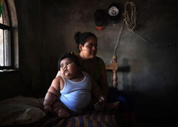 OBESITI dalam kalangan kanak-kanak boleh meningkatkan risiko diserang penyakit kencing manis. – GAMBAR HIASAN/AFP