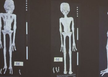 GAMBAR X-ray mumia yang ditemukan di lapangan terbang di Lima, Peru.-AFP