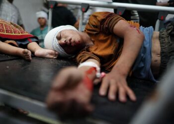 KANAK-kanak Palestin menerima rawatan di Hospital Nasser akibat cedera dalam serangan tentera Israel di Khan Younis, pada 25 Julai 2024.- AFP