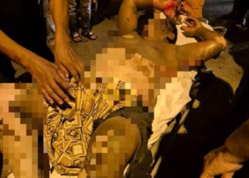 SALAH seorang mangsa diselamatkan selepas ruangan simpanan bateri bot meletup dalam kejadian di Pelantar Kampung Tanah Baru, Kuala Perlis, Perlis, semalam.-UTUSAN