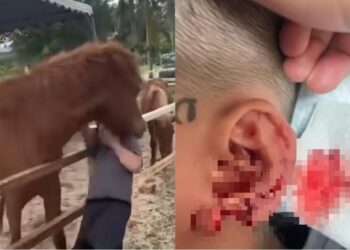 TANGKAP layar video tular memaparkan kejadian seorang kanak-kanak digigit kuda di sebuah ladang agropelancongan di Seremban pada 19 Januari lalu dan kecederaan yang dialami kanak-kanak itu.