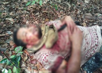 KEADAAN Nik Azhar Daud yang cedera parah diserang seekor beruang di ladang sawit di Kampung Telembuh, Jerangau Sungai di Dungun, Terengganu. - IHSAN KELUARGA