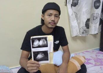 HASIL pemeriksaan buah pinggang Muhammad Faiz Fahmi Mohd. Zulkifli di hospital yang menunjukkan terdapat perubahan dari segi saiznya. - UTUSAN/ DIANA SURYA ABD WAHAB