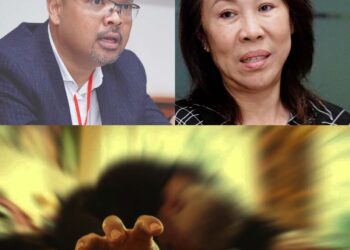 Indikasi untuk pembedahan ialah apabila epilepsi seseorang tidak dapat dikawal lagi dengan ubat terutama bagi pesakit mengalami jangkitan kuman dalam otak atau struktur abnormal sejak lahir. – GAMBAR HIASAN