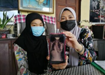 MURNI Mansor (kanan) menunjukkan tulang belakang anaknya, Shafiyah Laiyinah Ishak yang tidak lurus dan membentuk huruf C. Dia memerlukan dana sebanyak RM35,000 bagi menampung kos pembedahan anaknya itu.-UTUSAN/ZAKKINA WATI AHMAD TARMIZI.