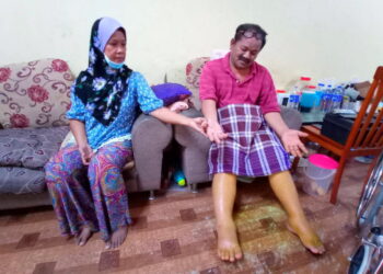 ROHA Ali (kiri) menunjukkan kaki suaminya, Mohd. Nazri Abd. Aziz yang membengkak selepas terjatuh sehingga menyebabkan kini tidak mampu berjalan ketika ditemui di rumah mereka di Taman Desa Sejahtera, Kota Tinggi, Johor. -UTUSAN/MASTURAH SURADI