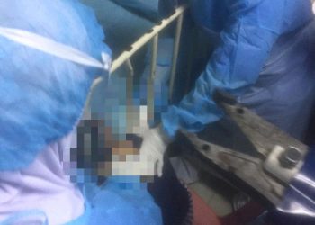 ANGGOTA bomba berusaha menyelamatkan kanak-kanak yang tersangkut pada besi katil di Hospital Tumpat malam tadi.