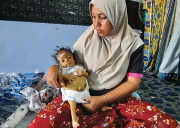 NOORAZLINAWATI Hashim memangku Nur Shafiyyah Hajatul Razli yang menghidap pelbagai komplikasi penyakit serta kecacatan anggota badan di rumahnya di Kampung Pagar Museh, Batu Puteh, Kulim, semalam. – UTUSAN/AZAHAR HASHIM