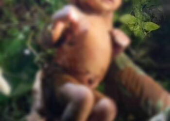 BAYI berusia dua hari ditemukan masih hidup walaupun dipenuhi luka dan gigitan serangga dalam hutan.-VIRAL PRESS